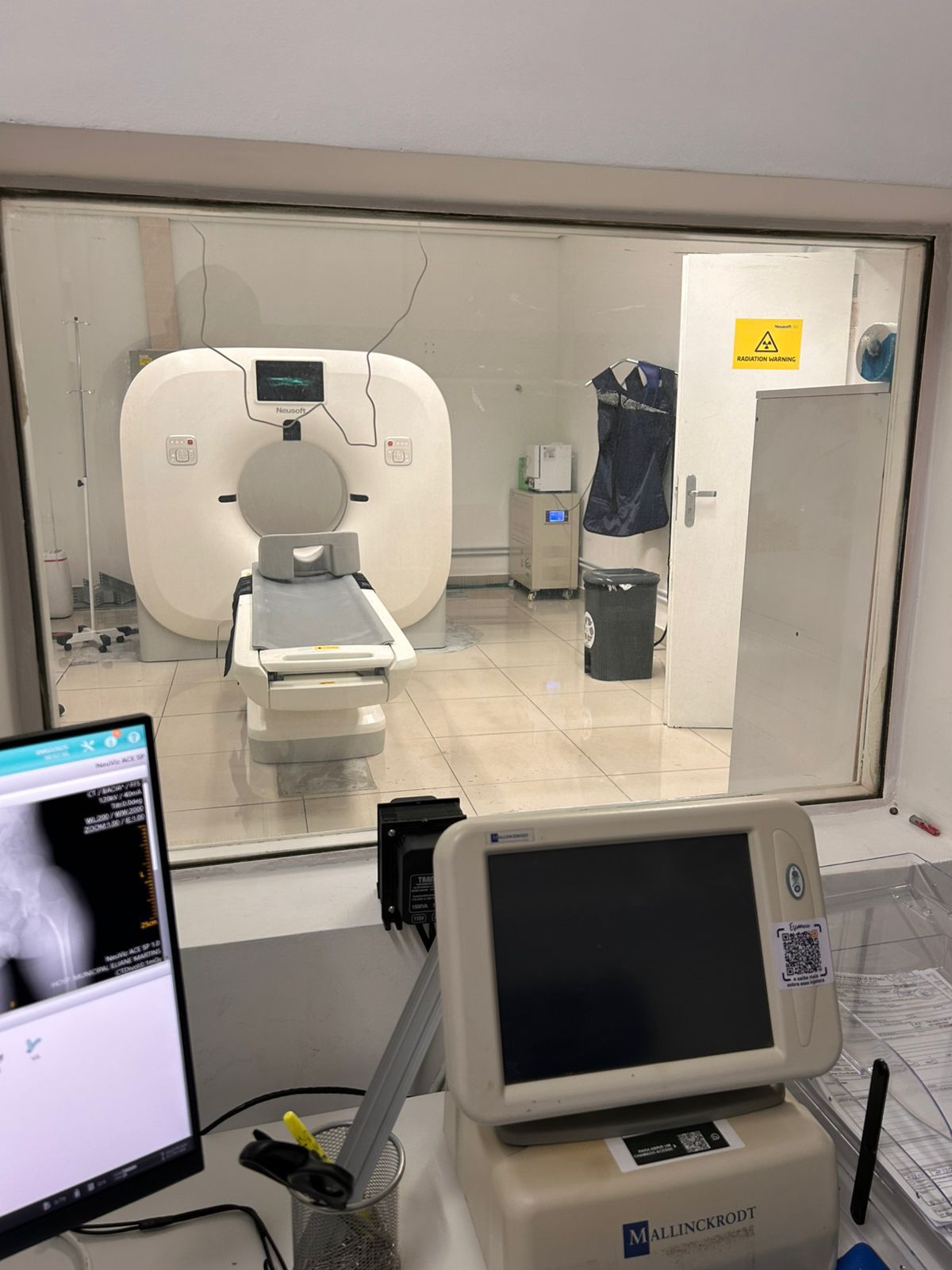 Ipatinga reforça rede pública de saúde com novo tomógrafo no Hospital Municipal